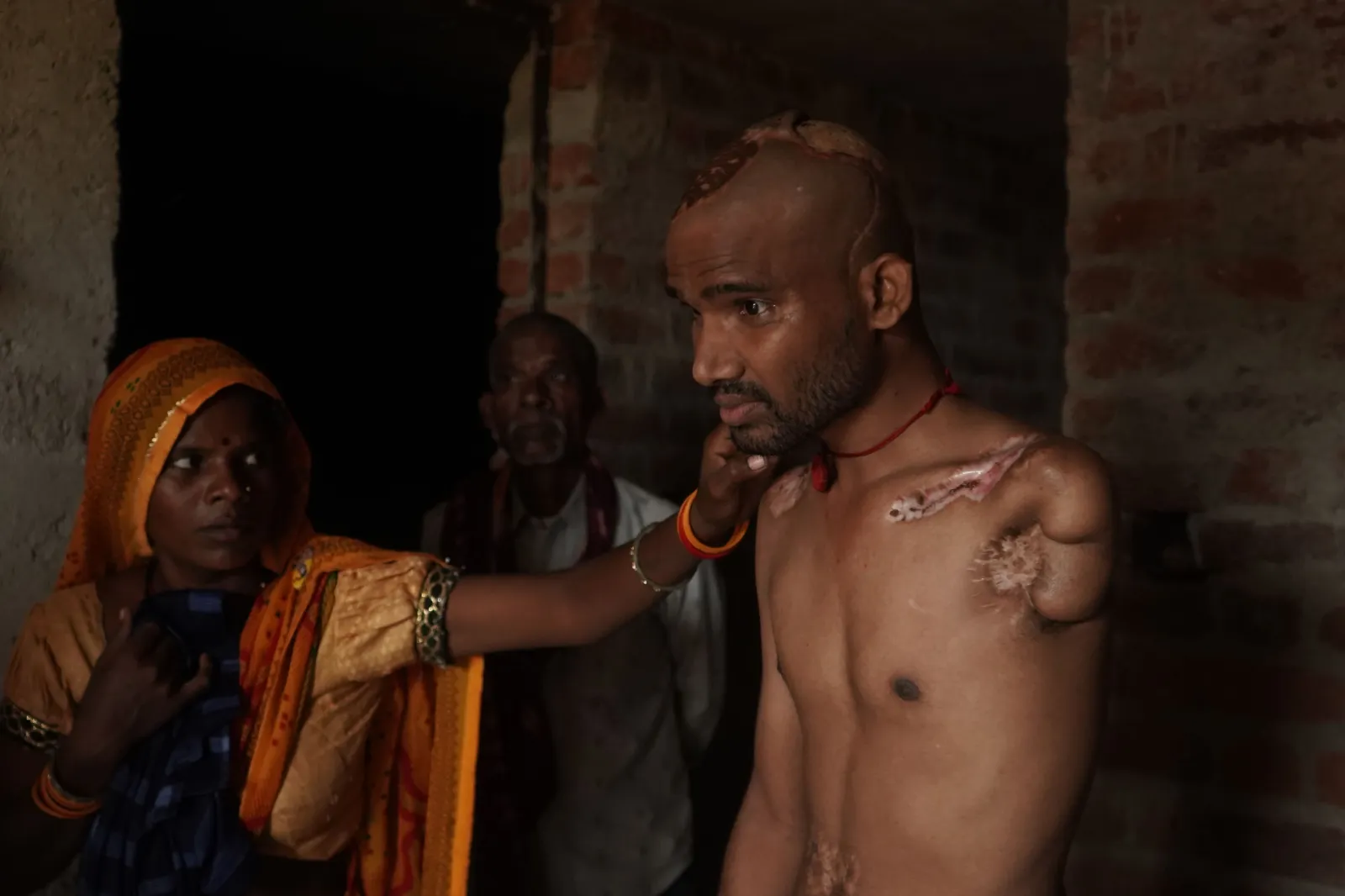 He Survived The Electric Shock. Now His Family Is Fighting To Bring Him Back To Life