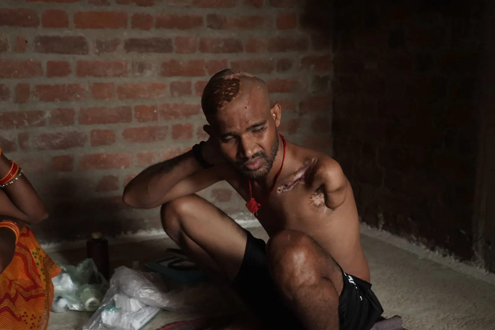 He Survived The Electric Shock. Now His Family Is Fighting To Bring Him Back To Life