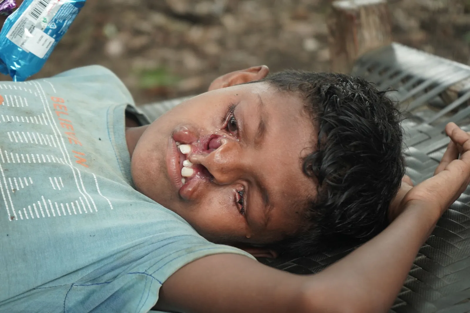 Help a Seven-Year-Old Eat, Smile, and Live Without Pain