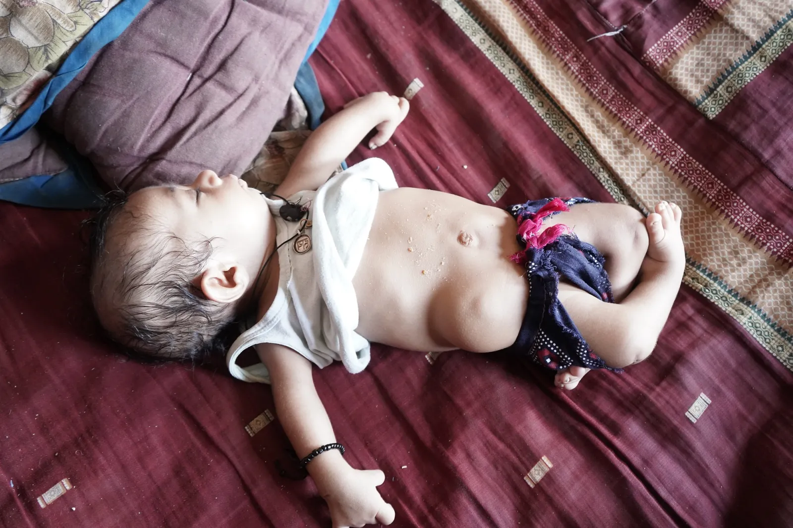 Two-Month-Old Saurabh Is Fighting For His Life