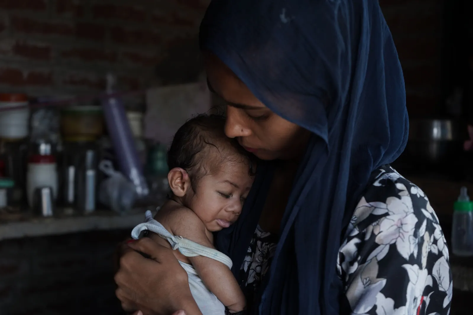 Two-Month-Old Saurabh Is Fighting For His Life