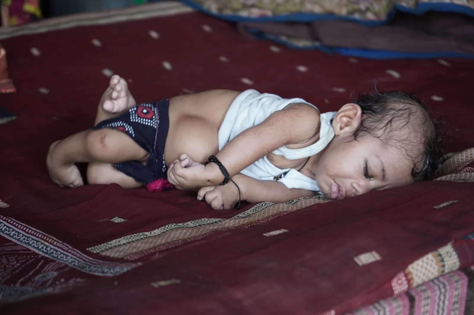 Two-Month-Old Saurabh Is Fighting For His Life