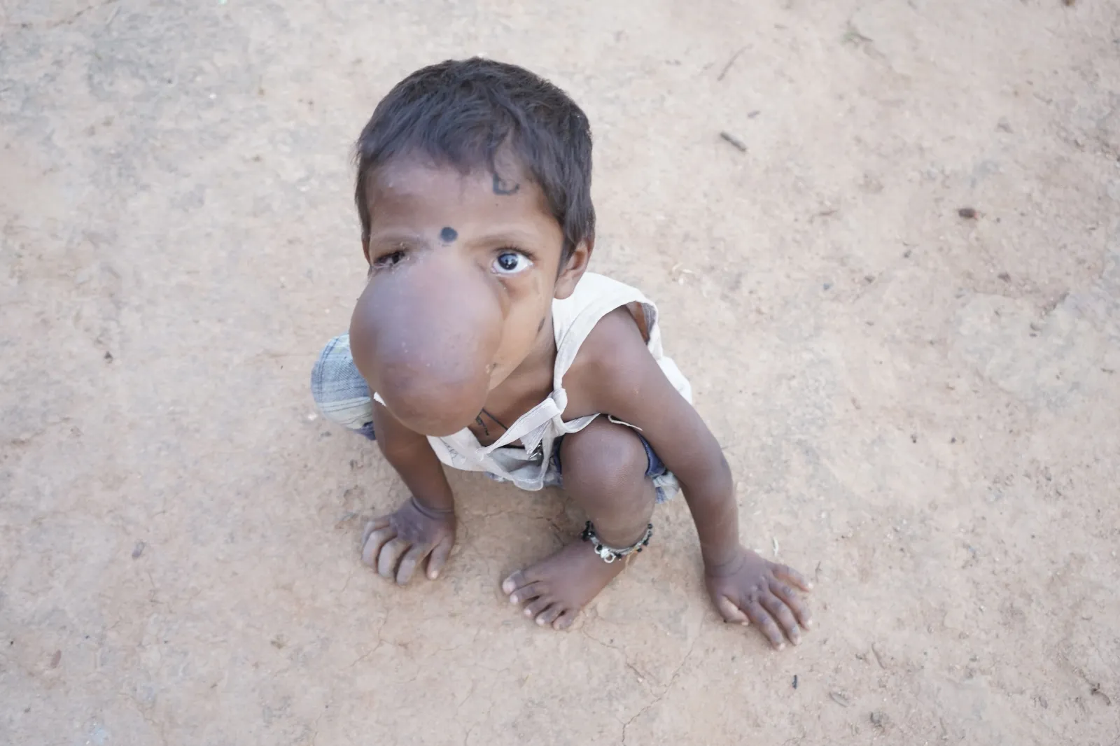 A Mother Who Eats Once a Day Is Begging to Save Her Son