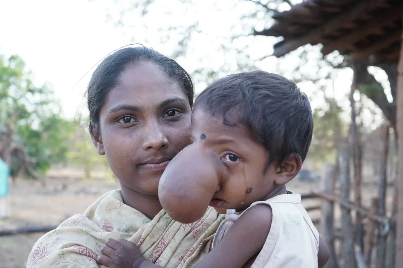 A Mother Who Eats Once a Day Is Begging to Save Her Son