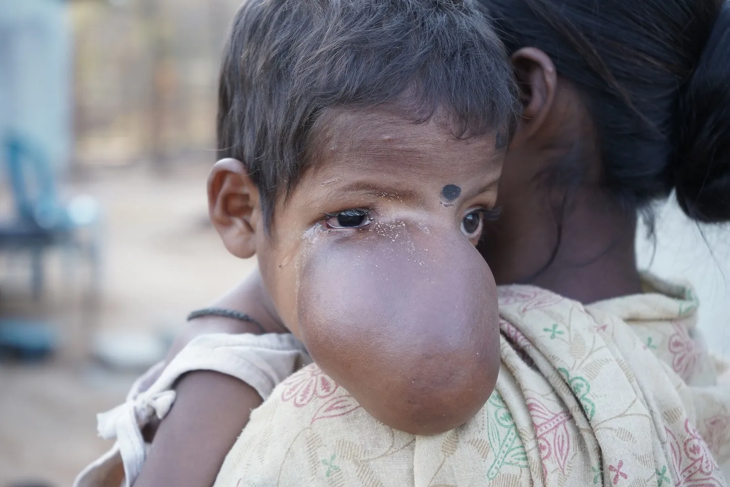A Mother Who Eats Once a Day Is Begging to Save Her Son