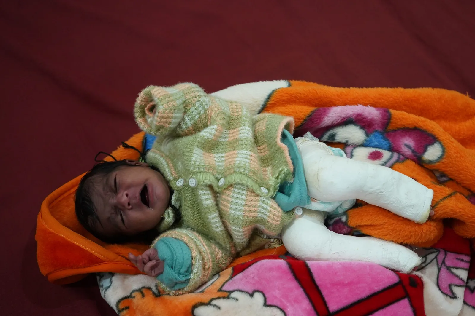 He Is Only 15 Days Old And Already Fighting For His Life