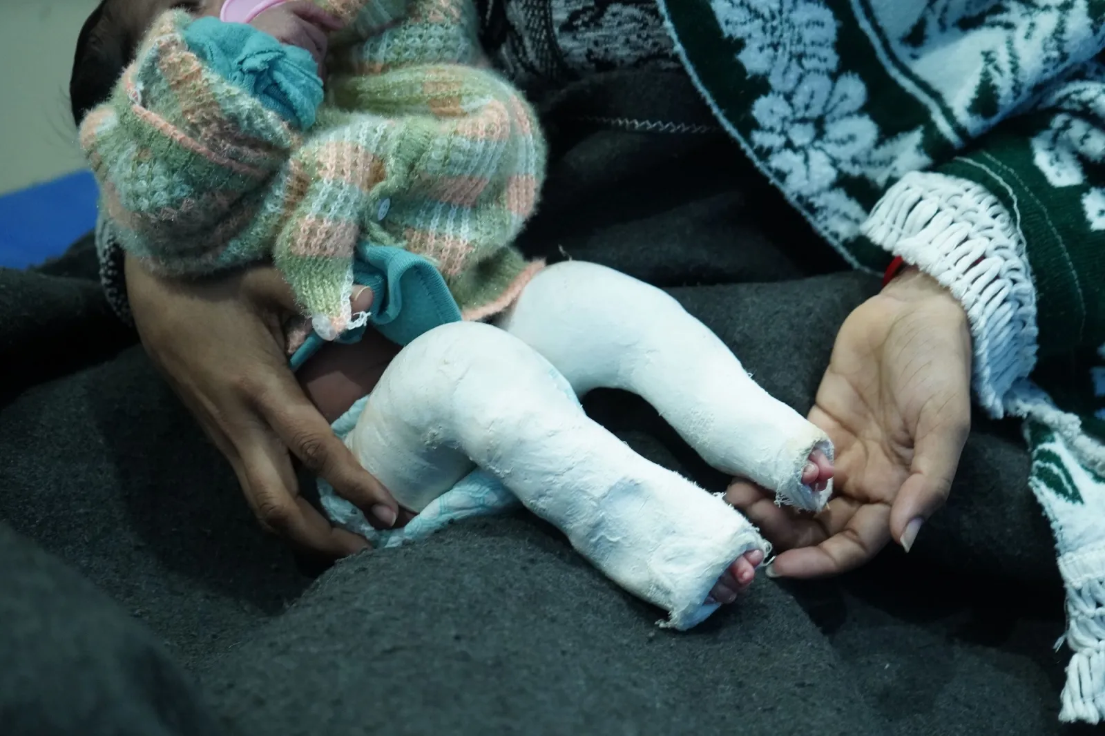 He Is Only 15 Days Old And Already Fighting For His Life