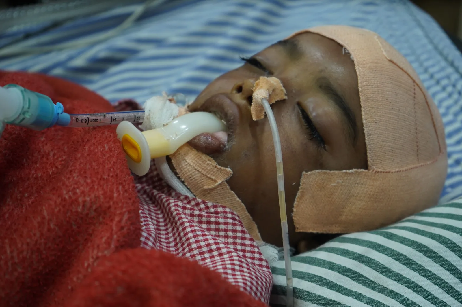 A Kite, A Fall, And A 9-Year-Old Fighting For His Life