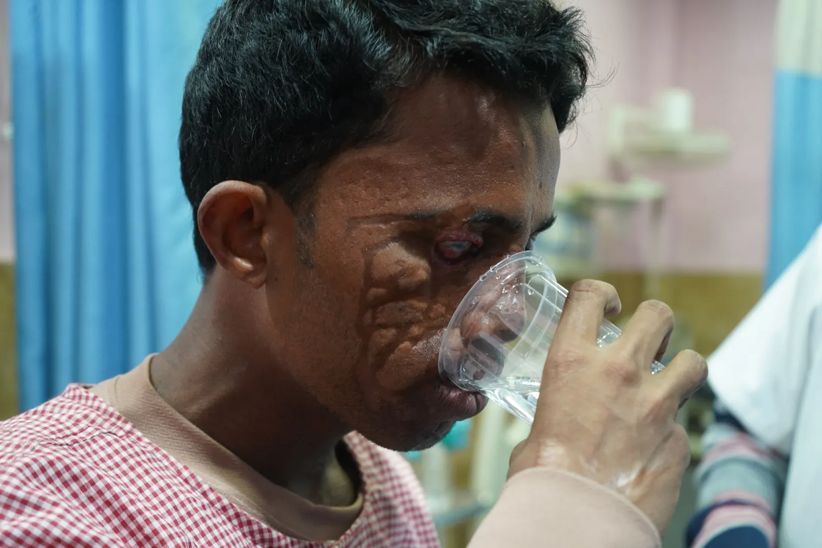 Acid Took His Family. It Should Not Take His Future.