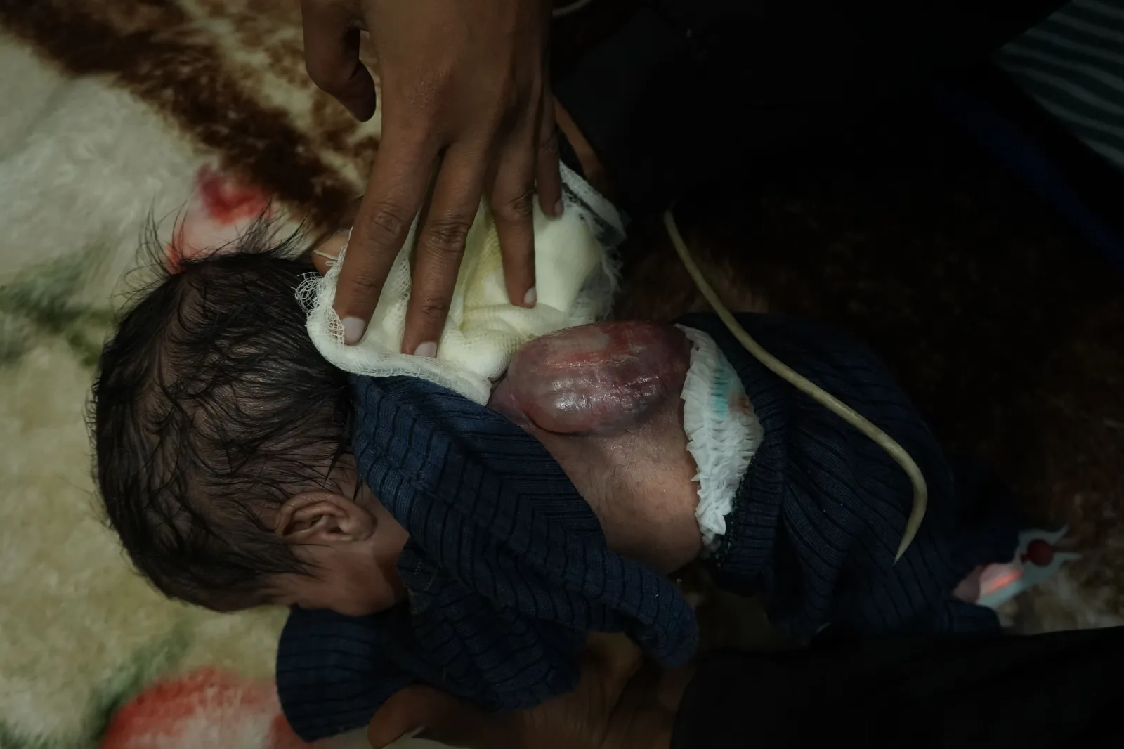 A 27-Day-Old Baby Fighting for Life