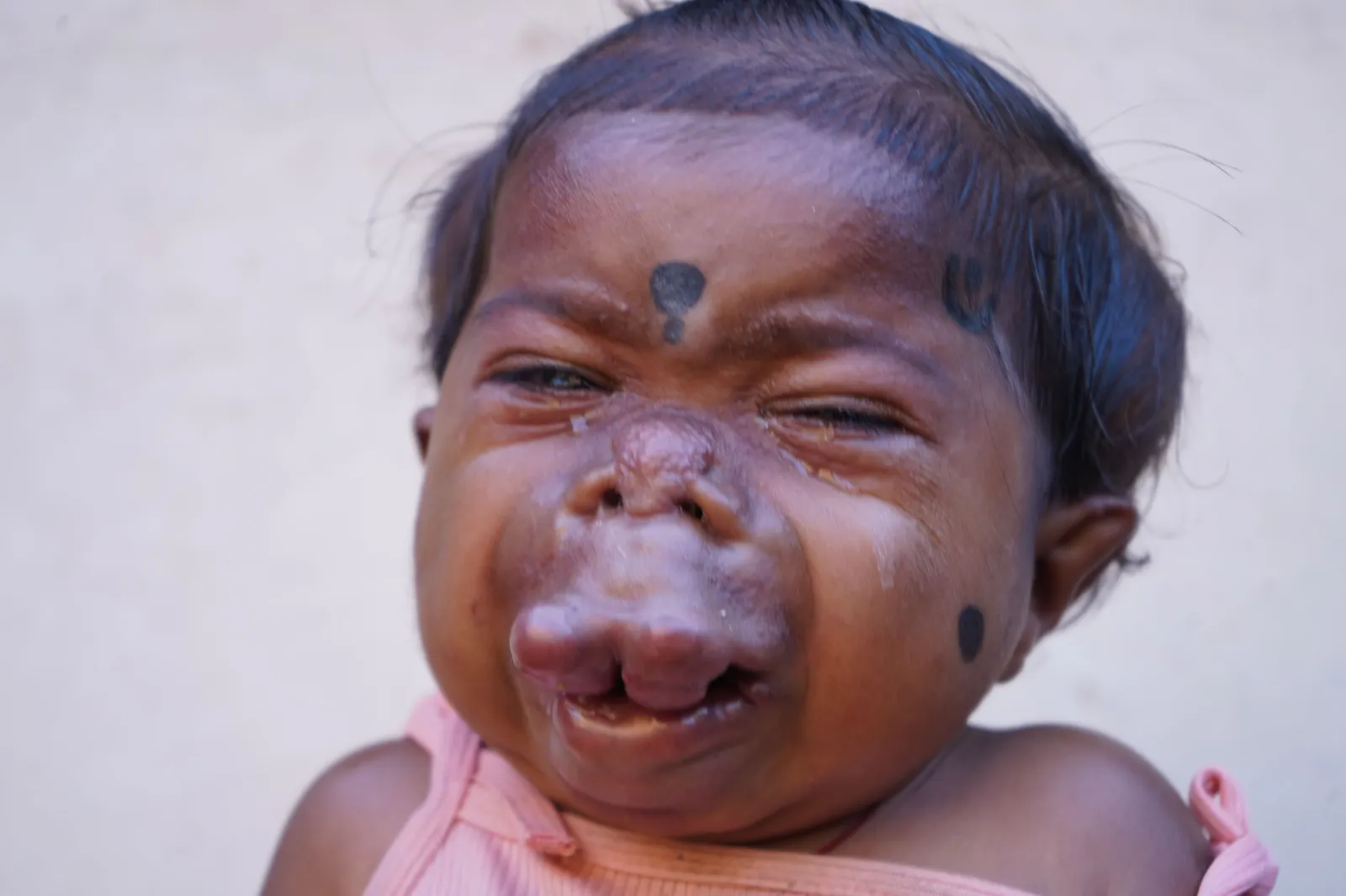 A Childhood Lost to Pain Before It Could Begin