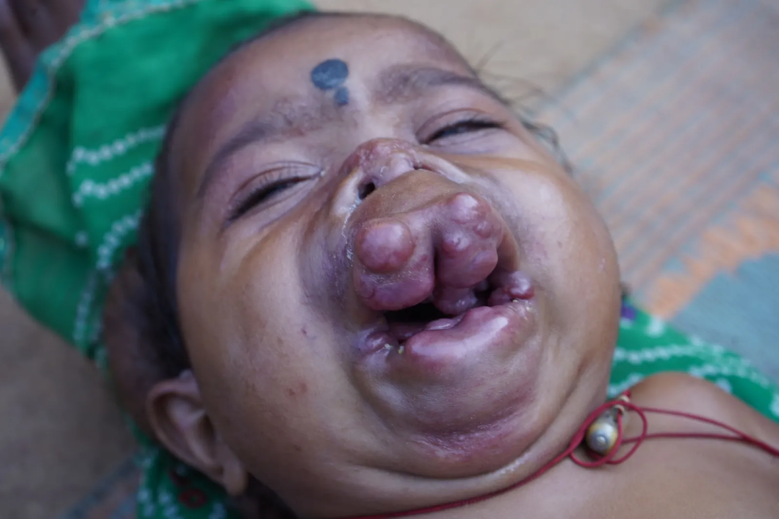 A Childhood Lost to Pain Before It Could Begin
