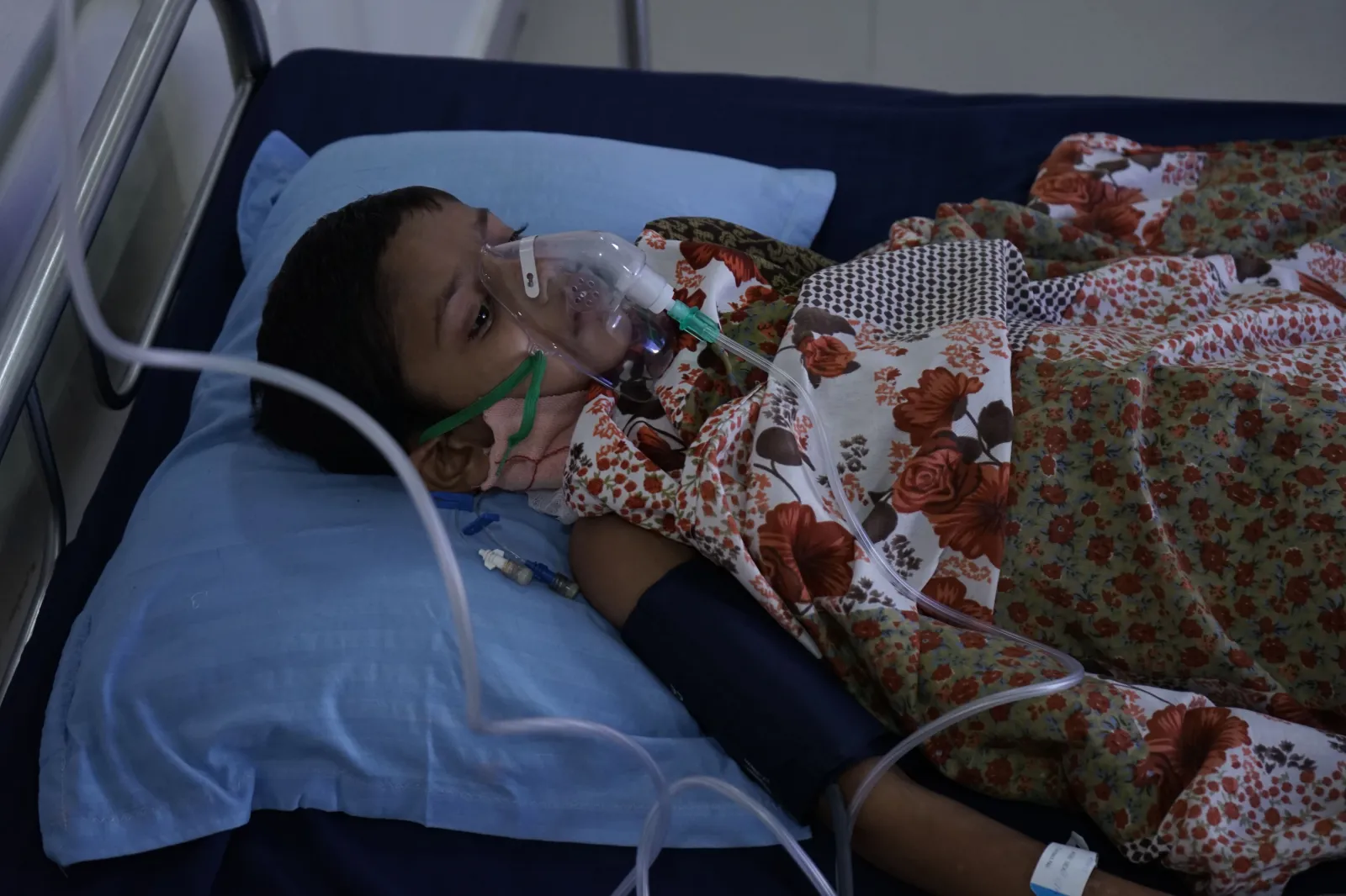 A Little Boy Fighting for His Life After a High Voltage Accident
