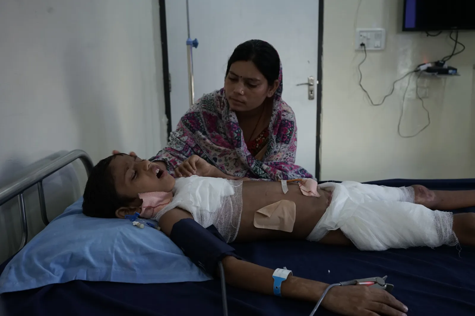 A Little Boy Fighting for His Life After a High Voltage Accident