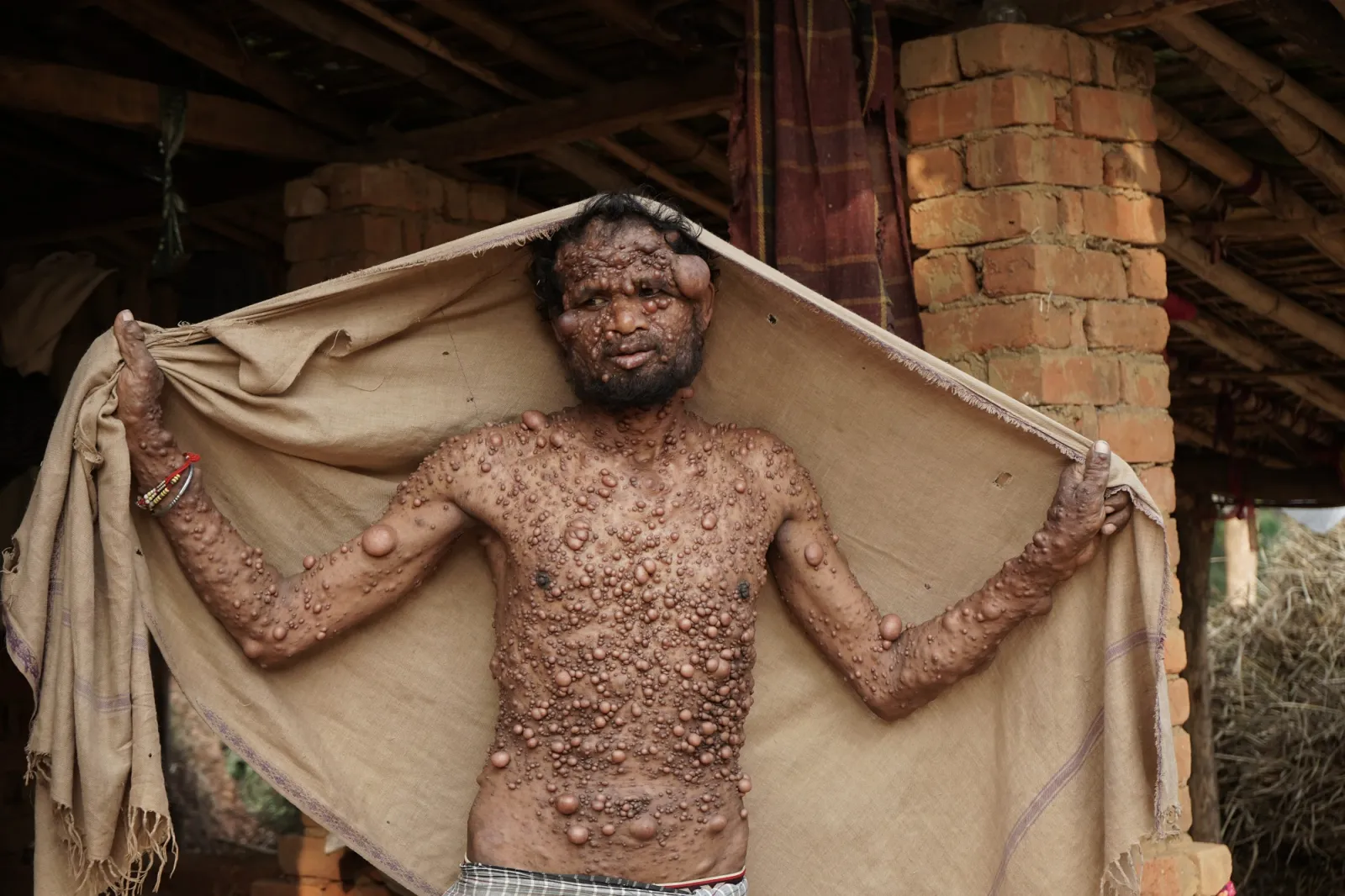 The Man Who Has Lived His Entire Life in Pain and Silence