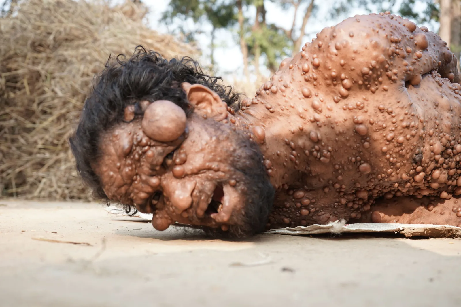 The Man Who Has Lived His Entire Life in Pain and Silence