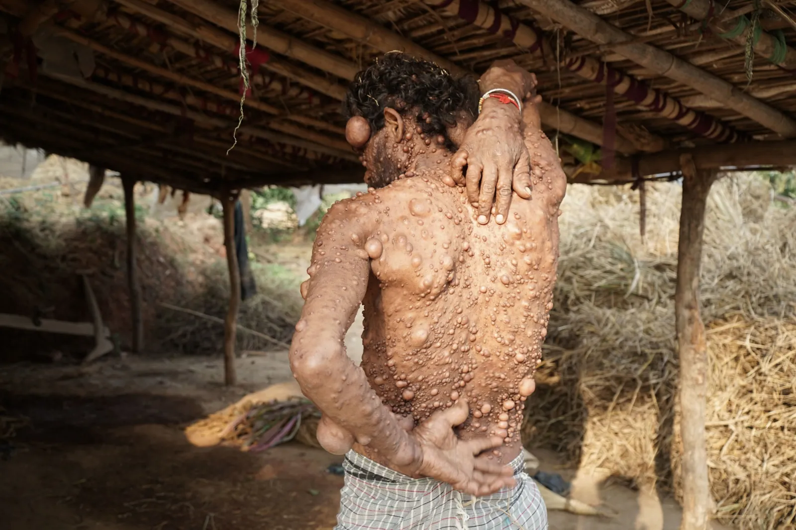 The Man Who Has Lived His Entire Life in Pain and Silence