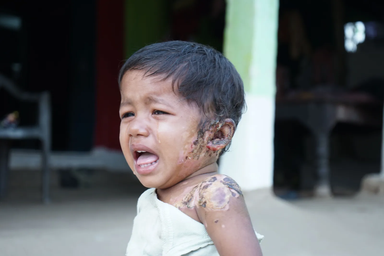 She Is Only 1 Year Old. Her Cry Filled the Entire Village. Now She Needs Us to Save Her Life.