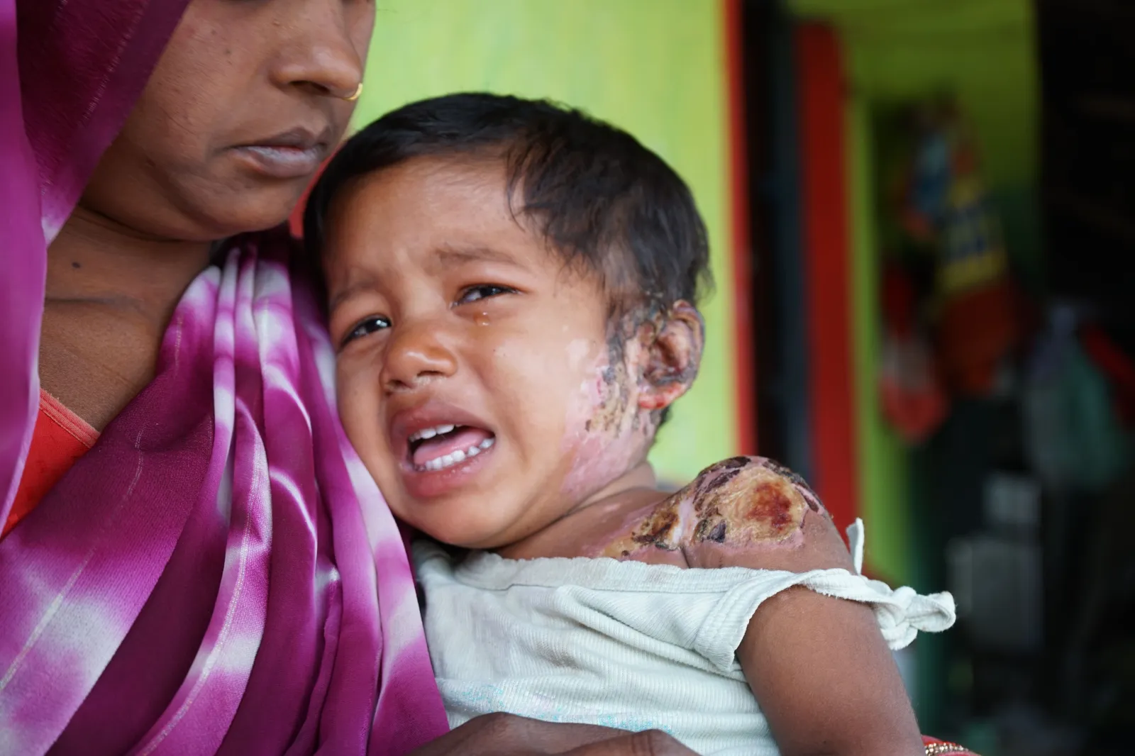 She Is Only 1 Year Old. Her Cry Filled the Entire Village. Now She Needs Us to Save Her Life.