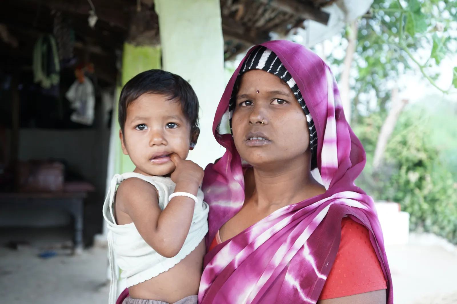 She Is Only 1 Year Old. Her Cry Filled the Entire Village. Now She Needs Us to Save Her Life.