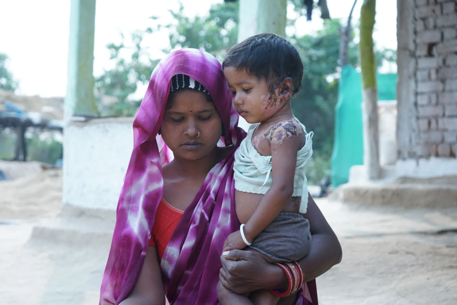 She Is Only 1 Year Old. Her Cry Filled the Entire Village. Now She Needs Us to Save Her Life.