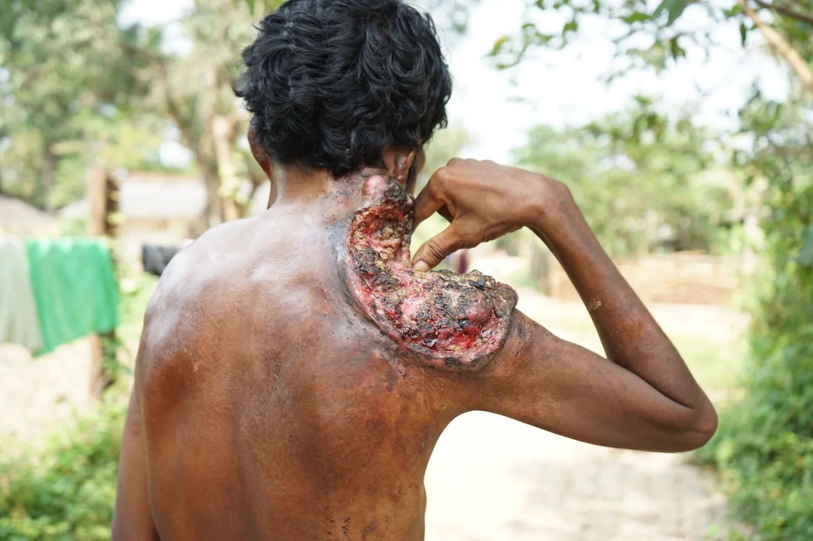 Thirty Years of Pain. One Last Chance to Save Baldhars Life