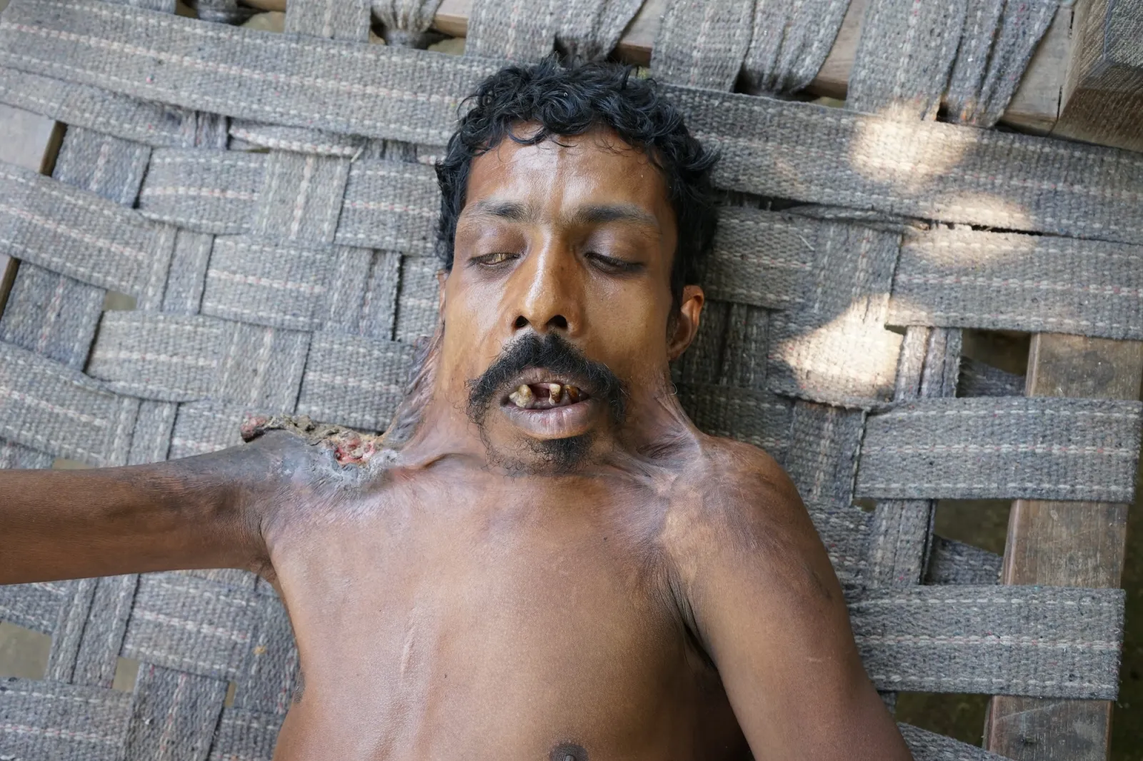 Thirty Years of Pain. One Last Chance to Save Baldhars Life