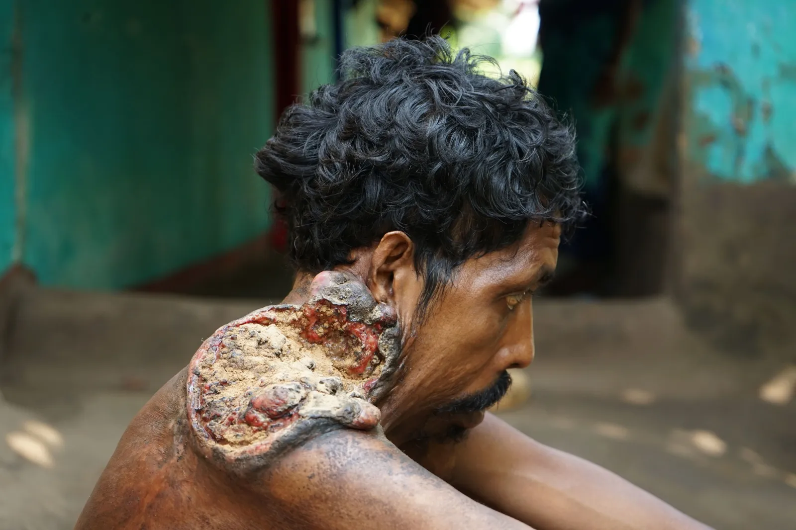 Thirty Years of Pain. One Last Chance to Save Baldhars Life