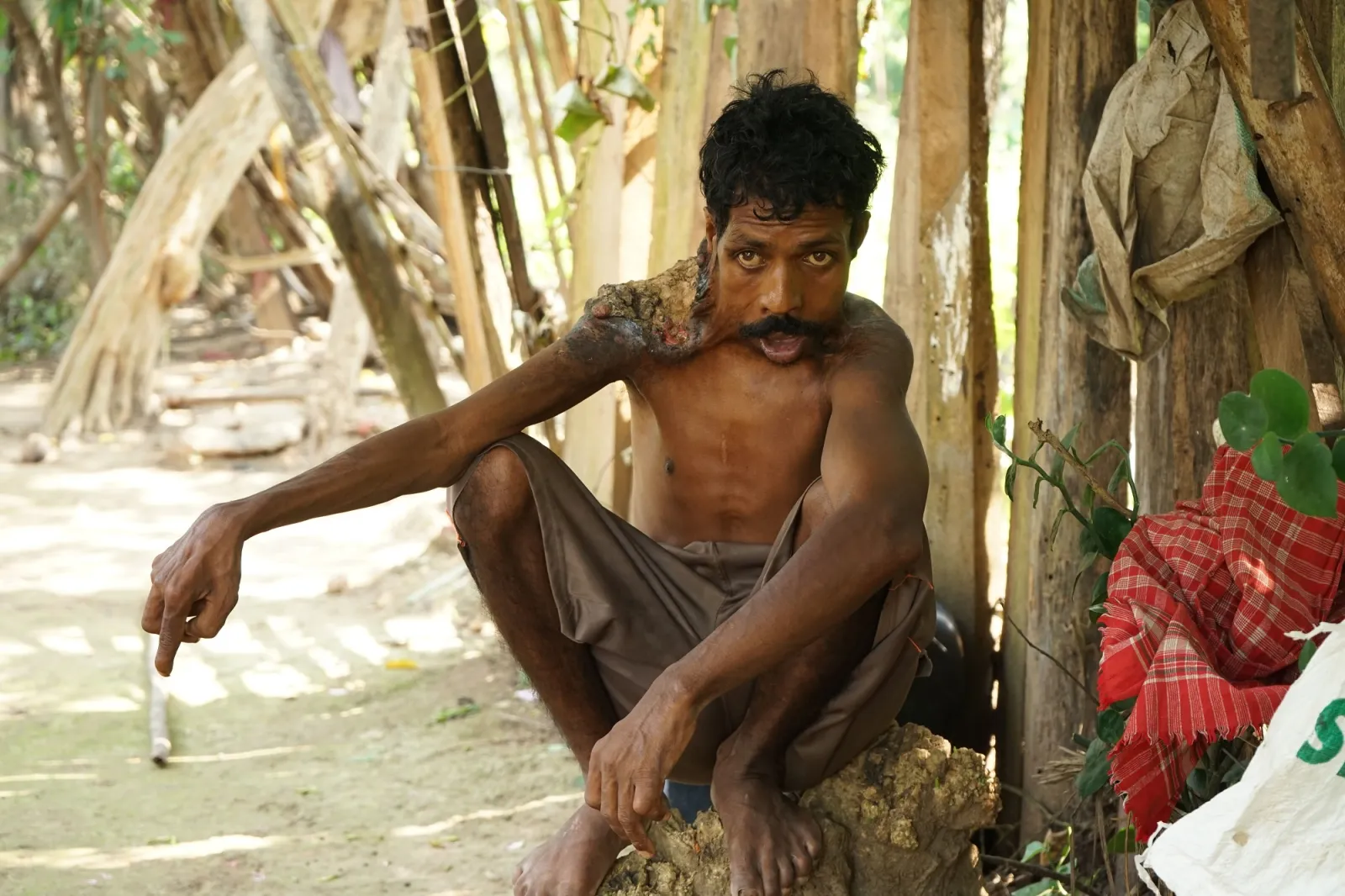 Thirty Years of Pain. One Last Chance to Save Baldhars Life