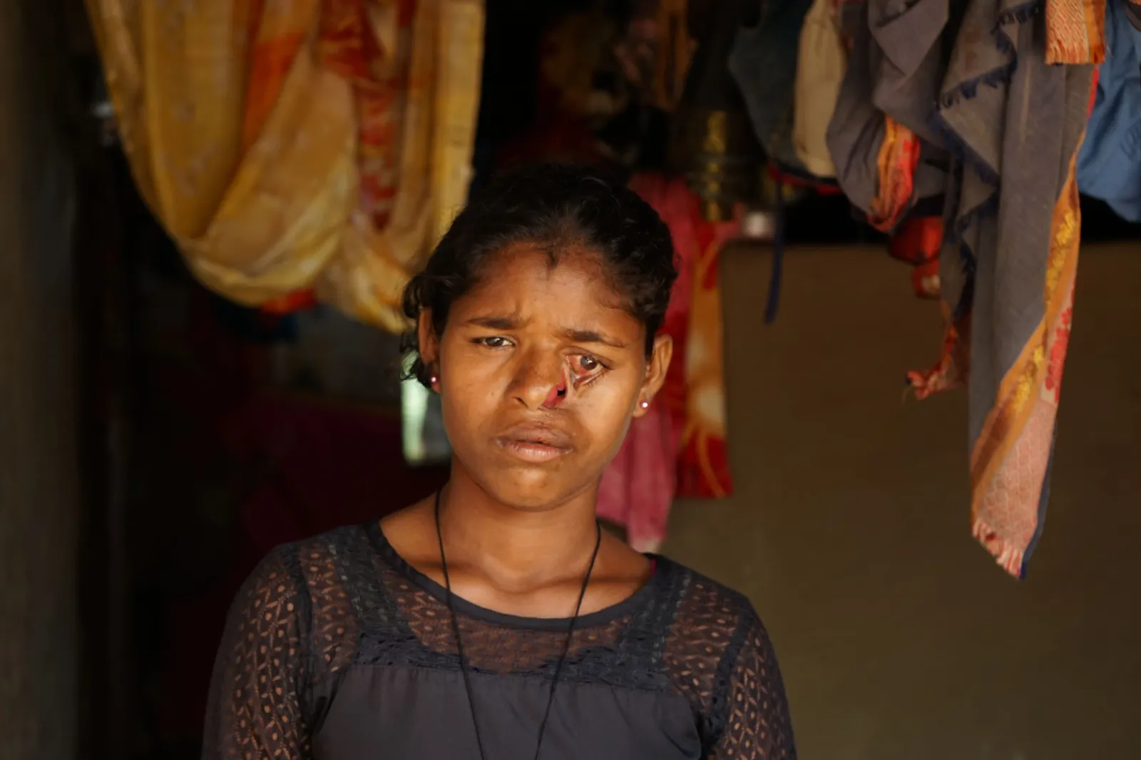A Childhood Marked by Pain, Not Play