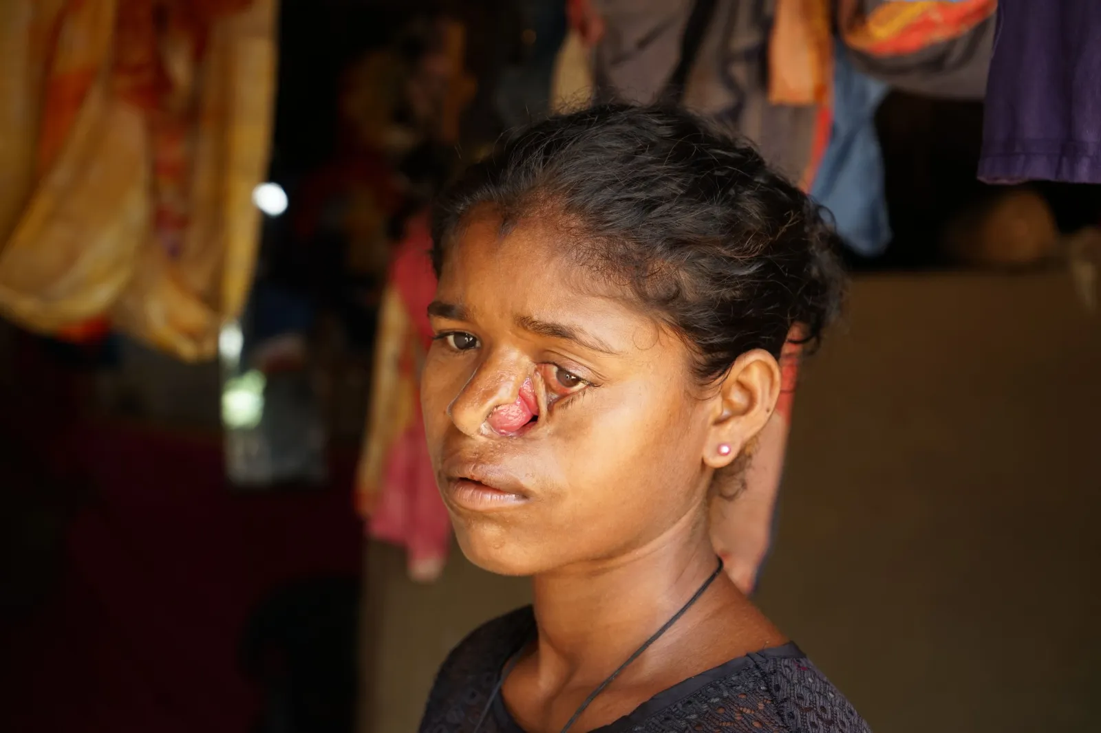 A Childhood Marked by Pain, Not Play