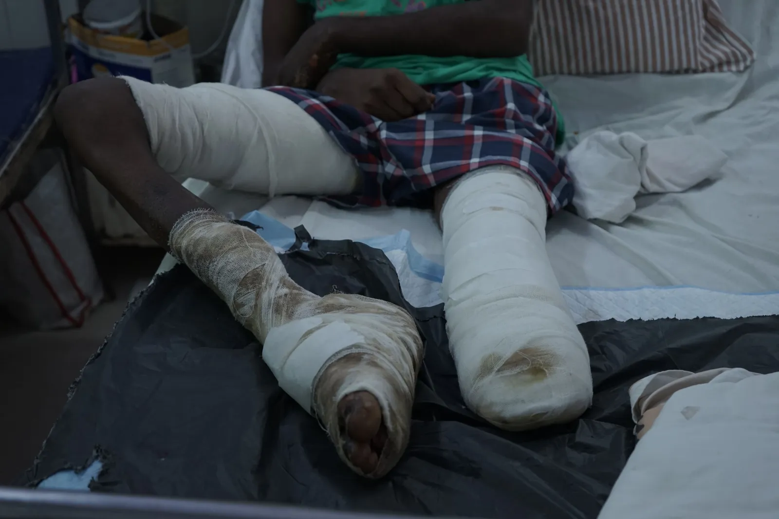 A Festival of Joy Turned Into a Nightmare — Now Durgesh Is Fighting to Stay Alive