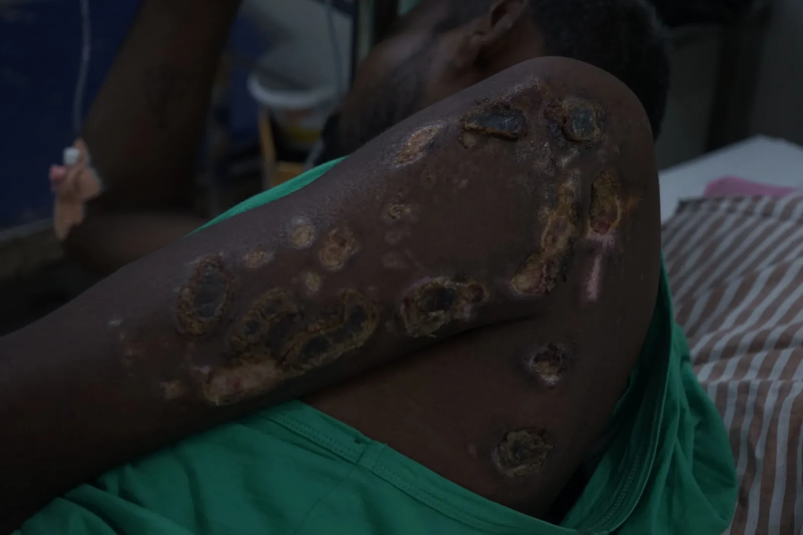 A Festival of Joy Turned Into a Nightmare — Now Durgesh Is Fighting to Stay Alive