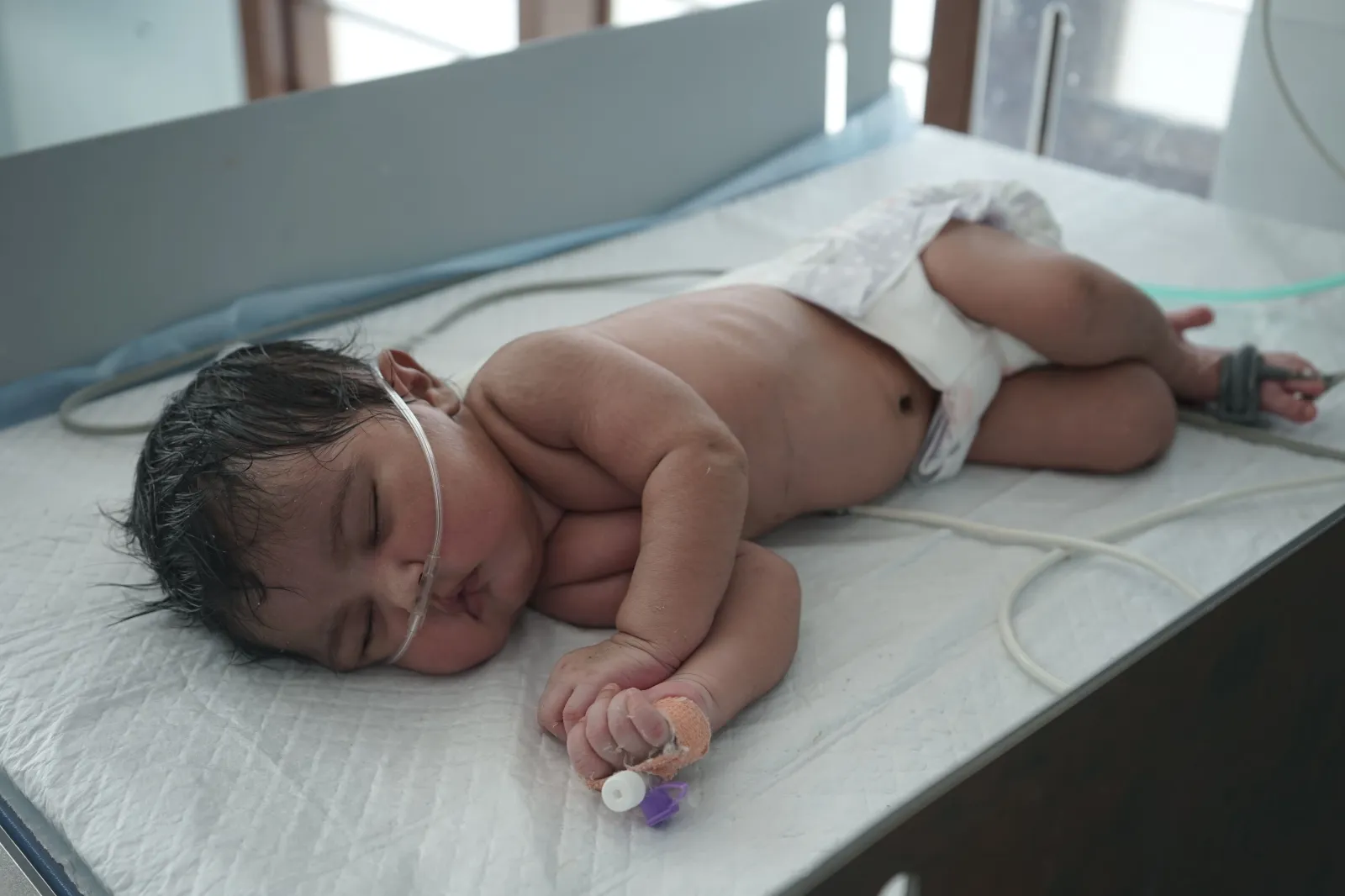 A Tiny Life Hanging Between Hope and Survival