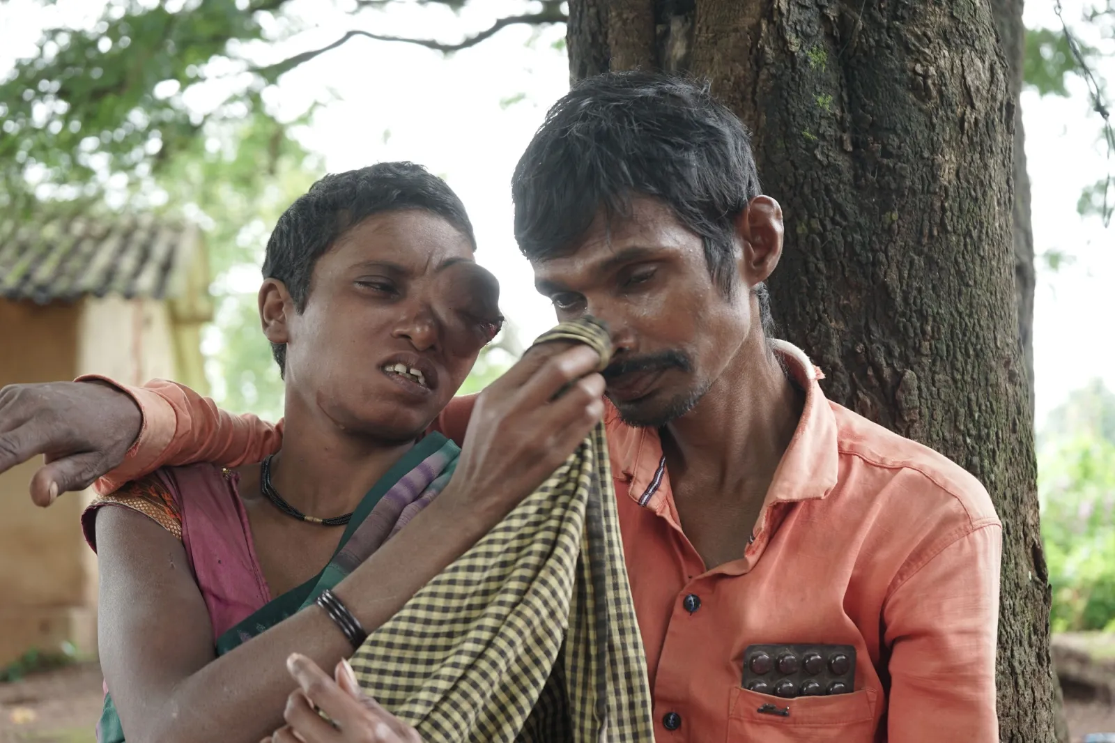 Save Malati From Losing Her Eye — And Her Life