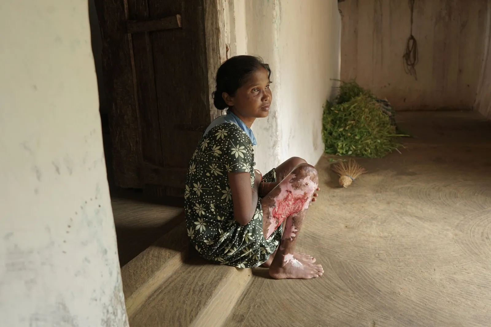 Her Body Burned, Her Spirit Didn’t: Stand With Hirmaniya