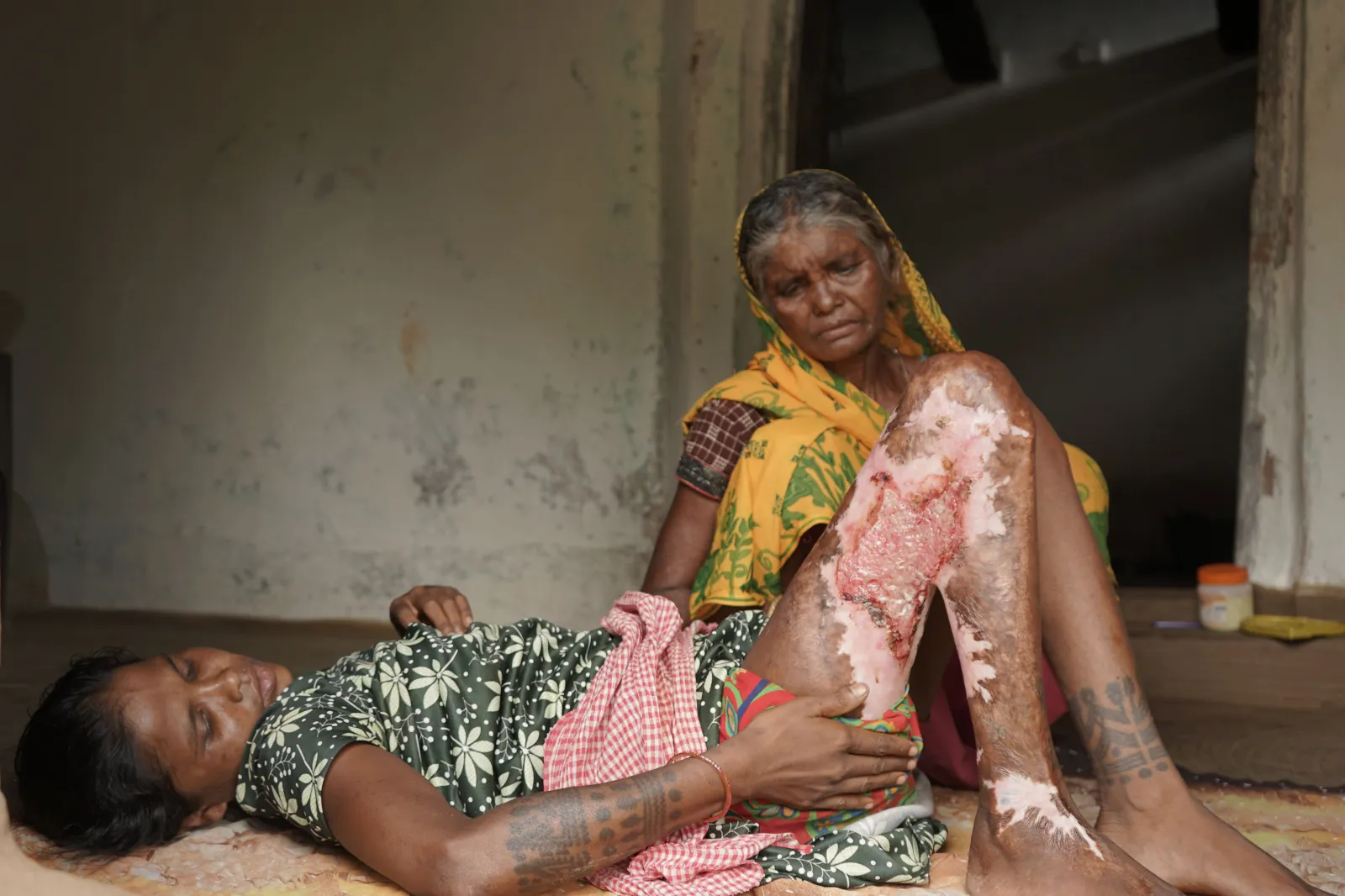Her Body Burned, Her Spirit Didn’t: Stand With Hirmaniya