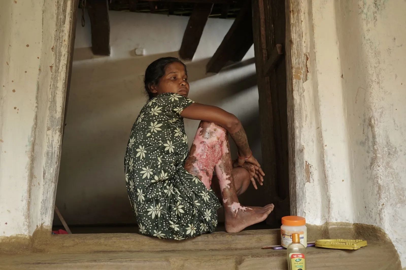 Her Body Burned, Her Spirit Didn’t: Stand With Hirmaniya