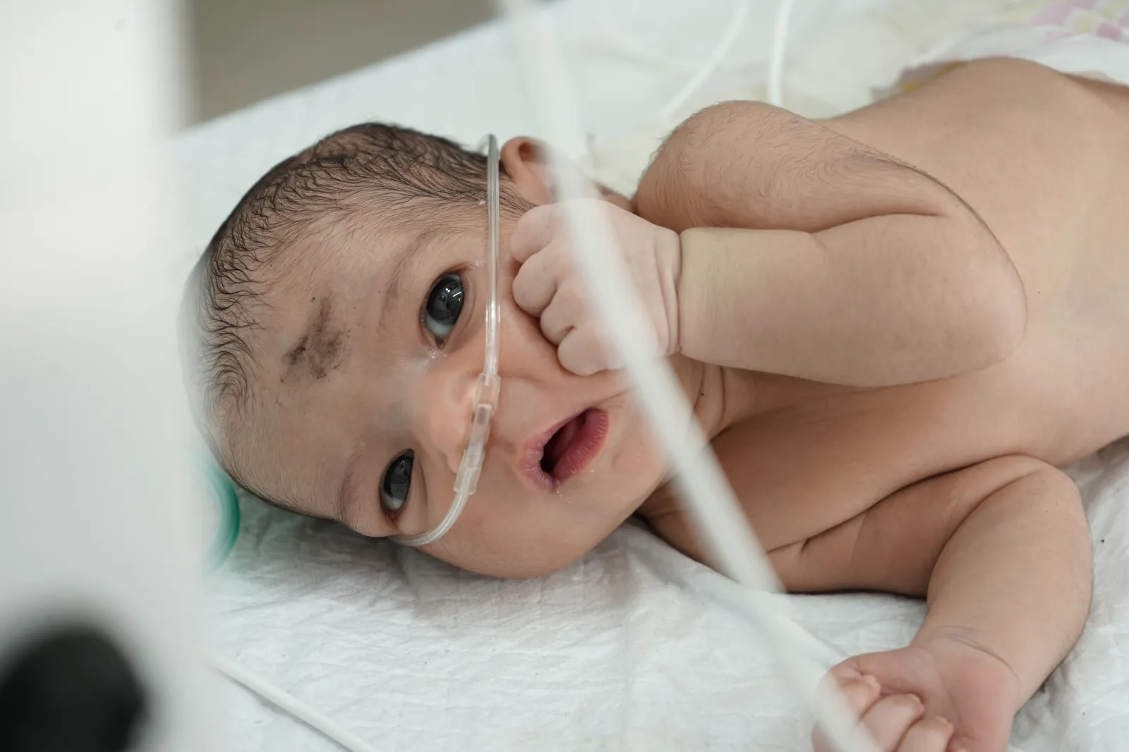 He Was Born Yesterday, Today He’s Fighting to Stay Alive