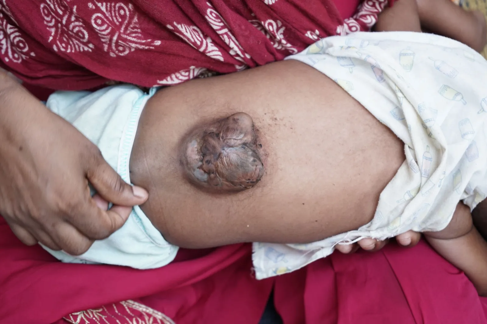 From ₹6,000 Salary to a ₹10 Lakhs Medical Bill. This Family Needs our Support