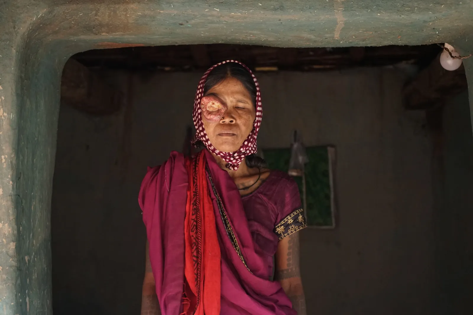 No Eyesight. No Income. No Support. Just One Last Hope—You