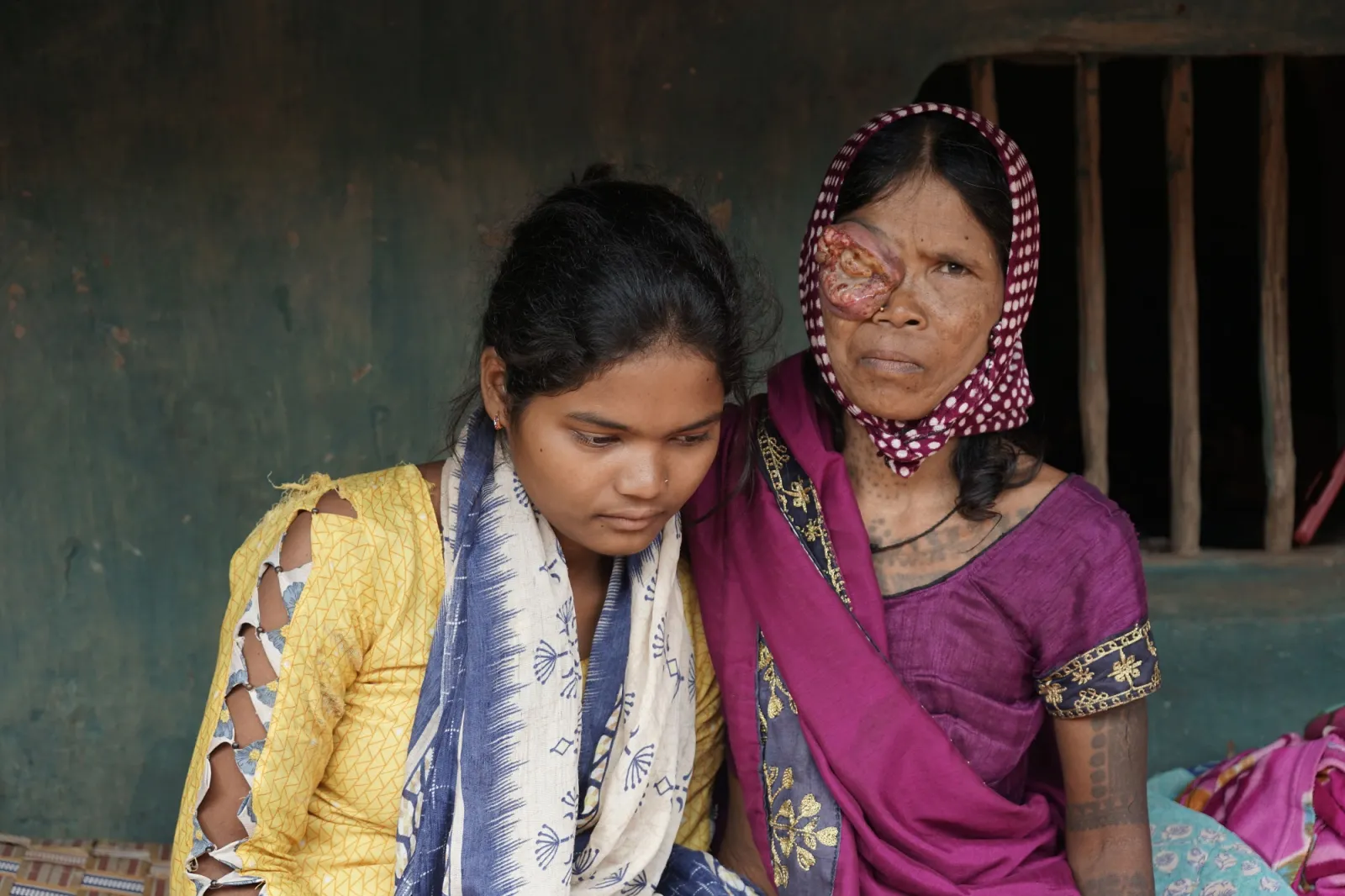 No Eyesight. No Income. No Support. Just One Last Hope—You