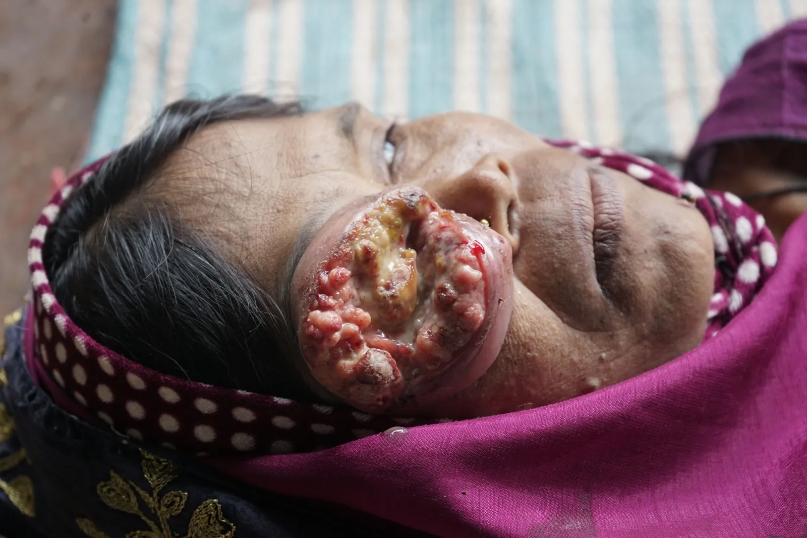No Eyesight. No Income. No Support. Just One Last Hope—You