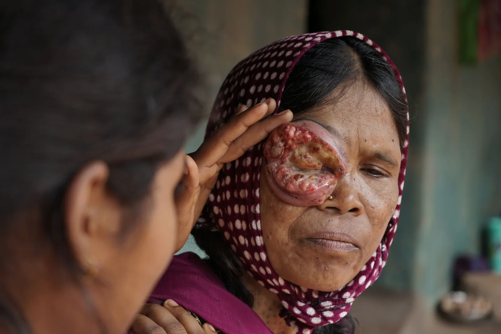 No Eyesight. No Income. No Support. Just One Last Hope—You