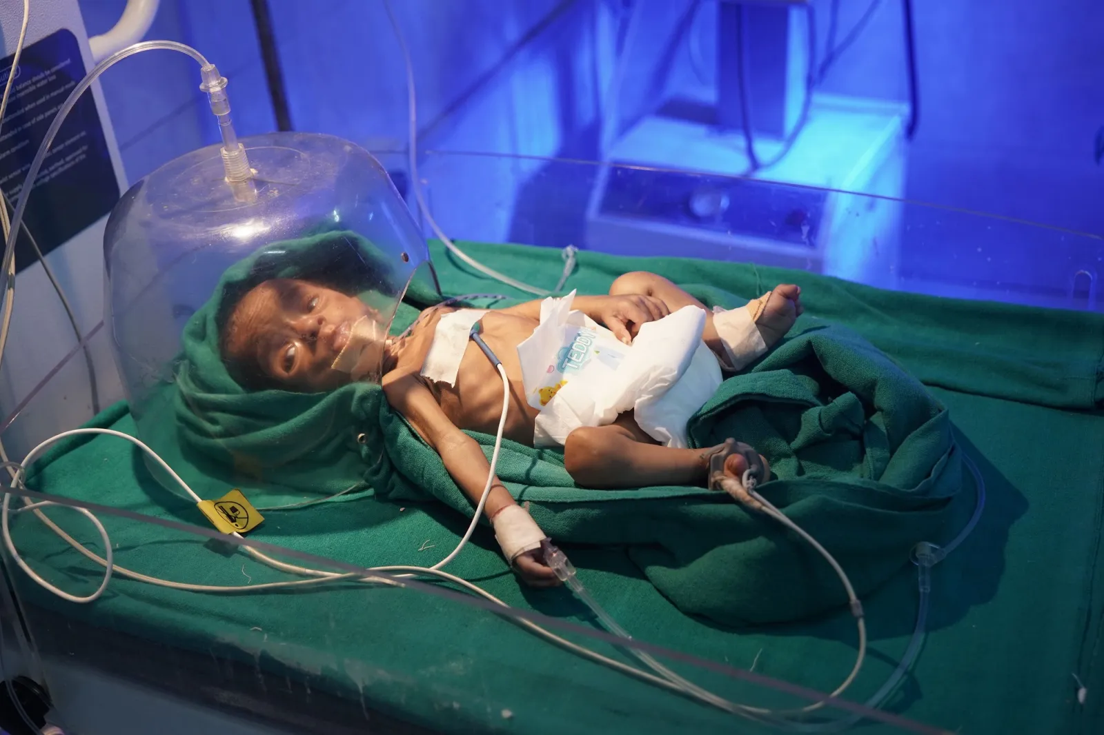 Usman had never Been Held by His Mother — But You Can Still Hold His Future