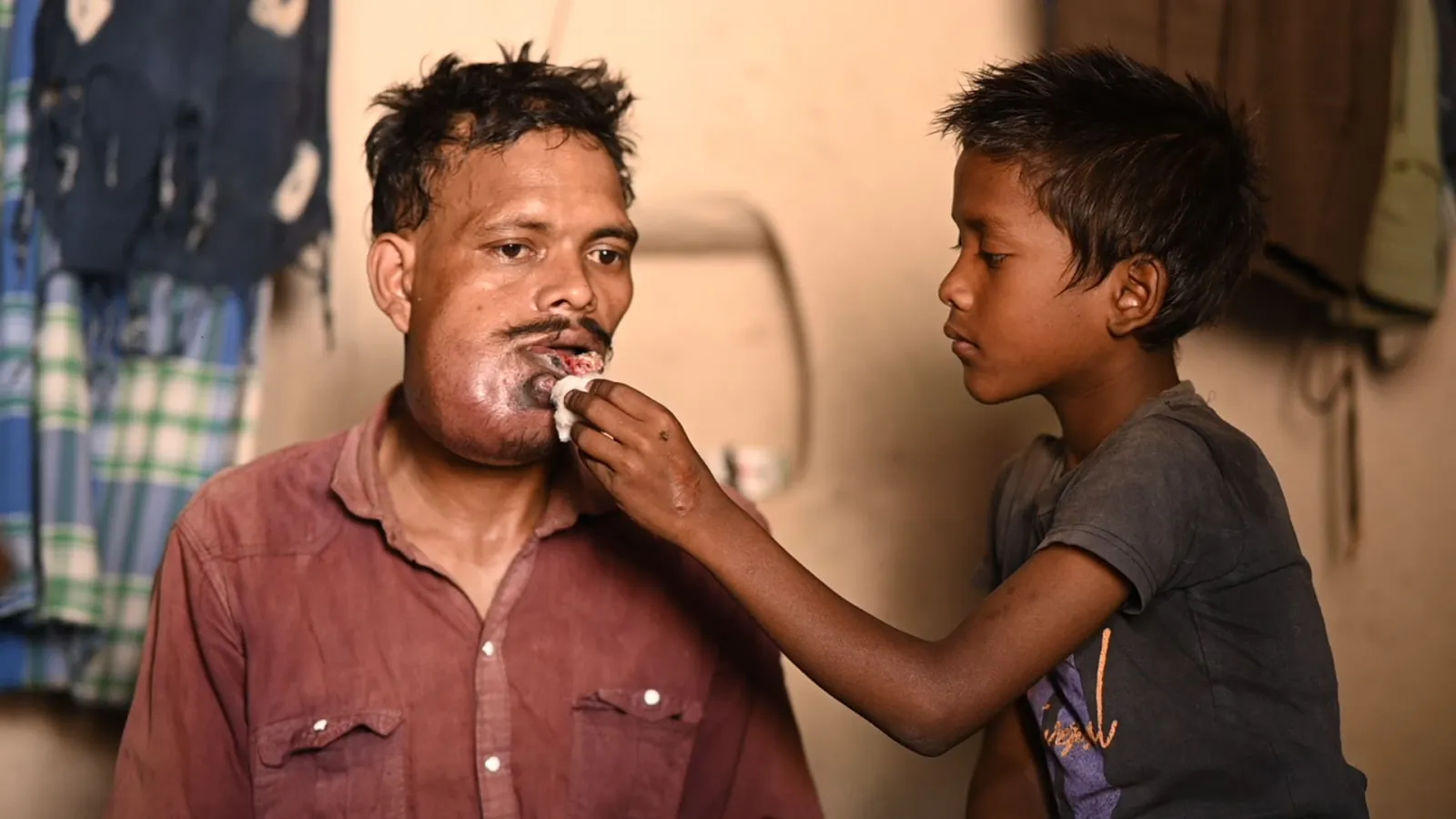 Dukhuram’s Pain Began With a Small Ulcer. Now, It’s growing into a Cancer.