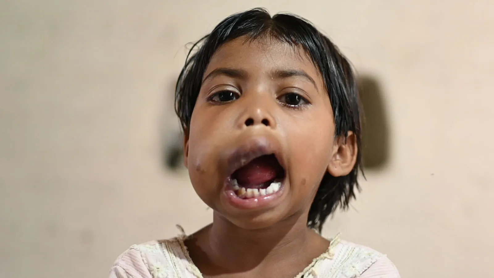 Mansi’s Smile is Fading. But Not Her Hope.