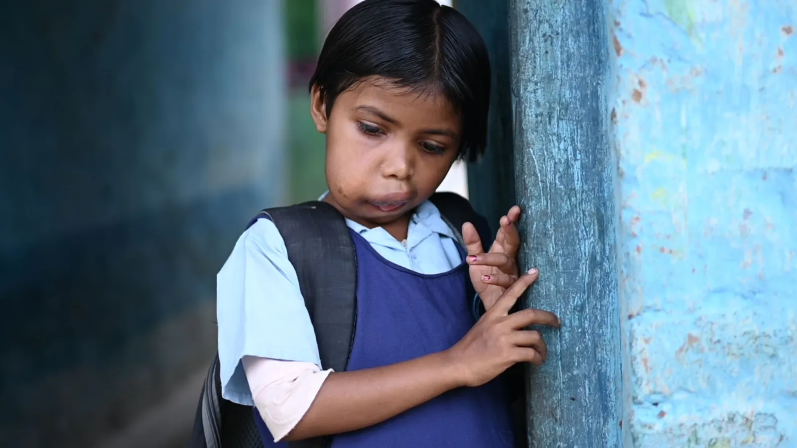 Mansi’s Smile is Fading. But Not Her Hope.