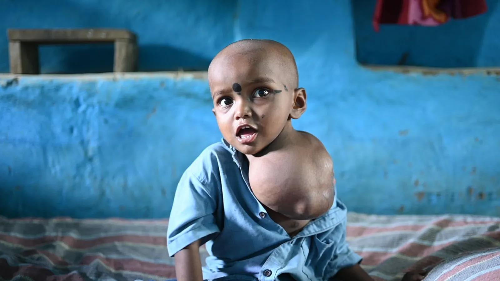 Save Little Kamna: A 4-Year-Old’s Fight for Life and Childhood