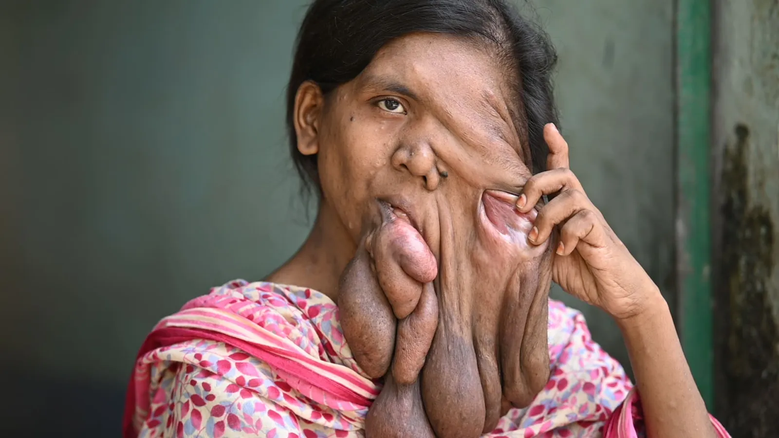 This face scares people. But behind it is just a little girl named Samima.